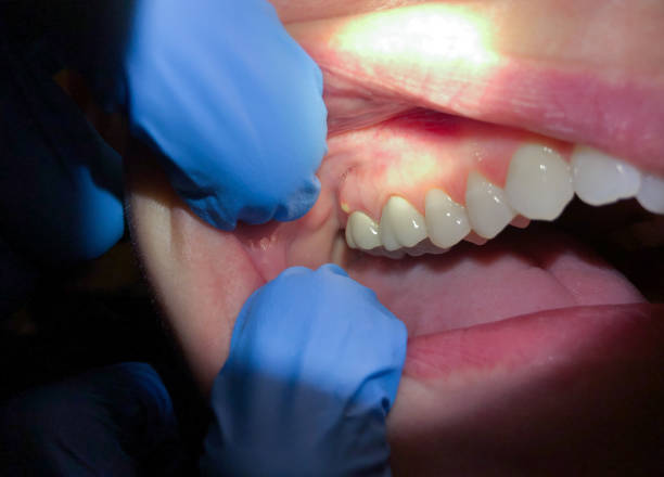 Best Cosmetic Emergency Dentistry in Jefferson, MD