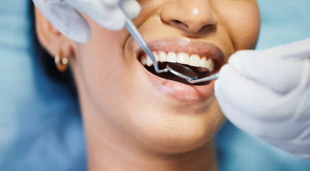 Best Emergency Tooth Extraction in Jefferson, MD