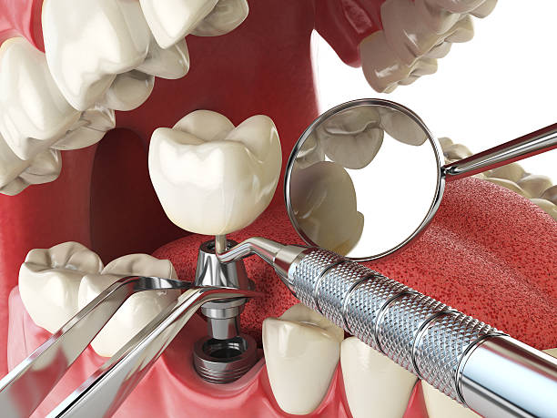 Best Emergency TMJ Treatment in Jefferson, MD