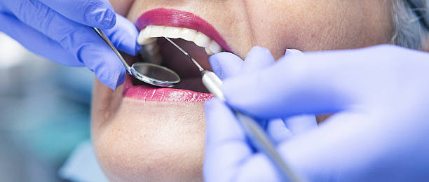 Best After-Hours Dental Trauma Care in Jefferson, MD
